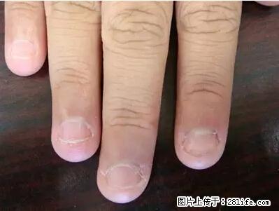 剪指甲、挖耳屎，这些日常小动作竟隐藏大危害！ - 许昌生活资讯 - 许昌28生活网 xc.28life.net